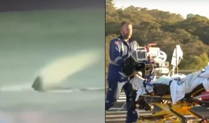 В Австралии акула оторвала сёрферу ногу (4 фото + 1 видео)