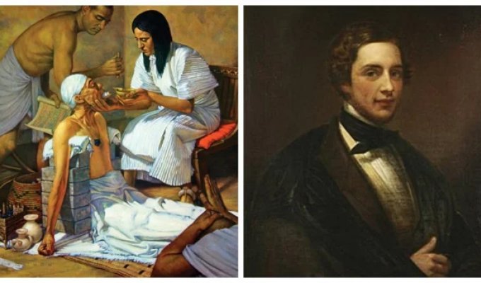 Папирус Эдвина Смита: древнейший учебник хирургии, опередивший своё время (6 фото)