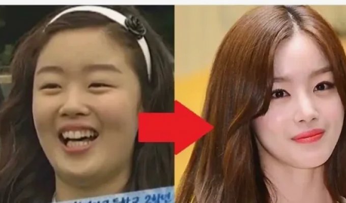 Stars are bought: the incredible rise of plastic surgery in Korea due to celebrity advertising (8 photos)