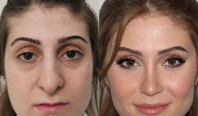 People who decided to undergo plastic surgery - and changed dramatically (13 photos)