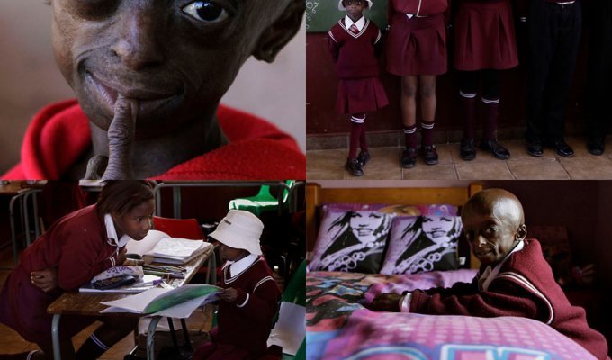 12-летняя девочка-старушка из ЮАР (14 фото)