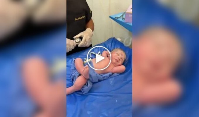 A newborn surprises everyone with its calmness