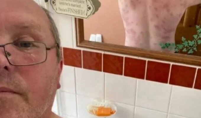 A British man survived after being stung 240 times (4 photos)