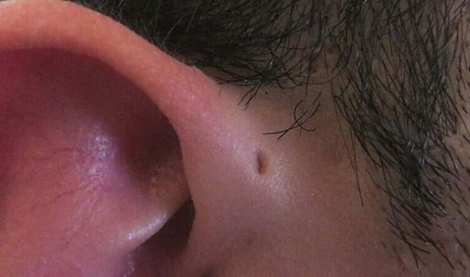 Вы знаете, почему у некоторых людей есть крошечные отверстия над ушами? (5 фото)