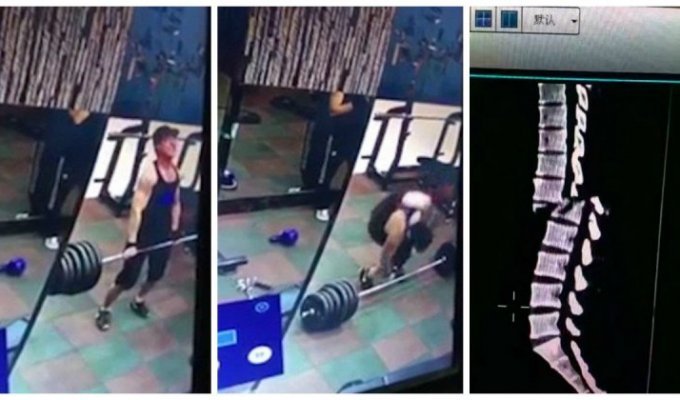 Китайский тяжелоатлет сломал позвоночник при попытке поднять штангу со слишком большим весом (2 фото + 1 видео)