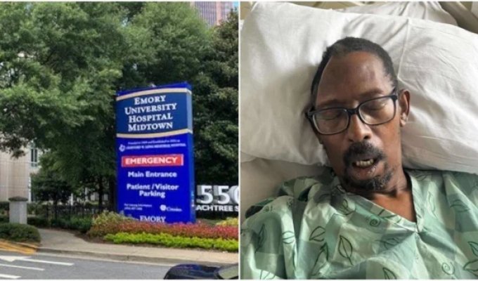 A patient in Atlanta sues doctors who lost a piece of his skull (3 photos + 1 video)