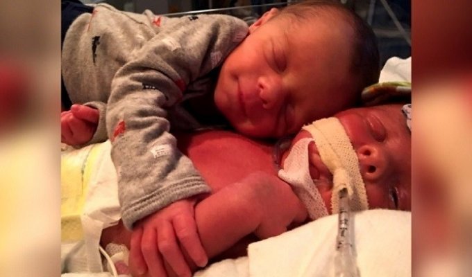 Душераздирающее фото новорожденного ребёнка, прощающегося со своим близнецом (5 фото)