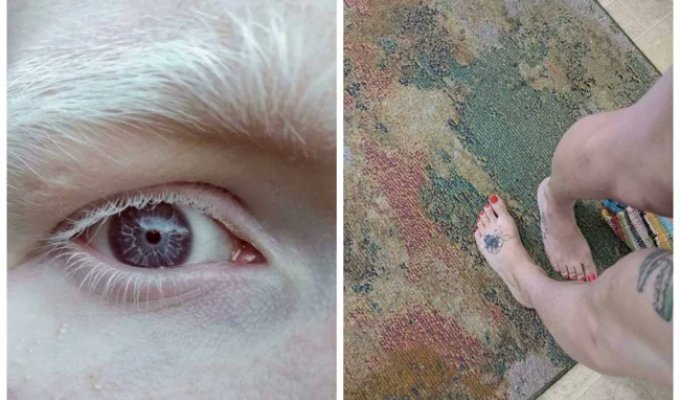 Six Fingers on Both Hands, Violet Eyes, and Other Unique Physical Traits of Real People (23 photos)