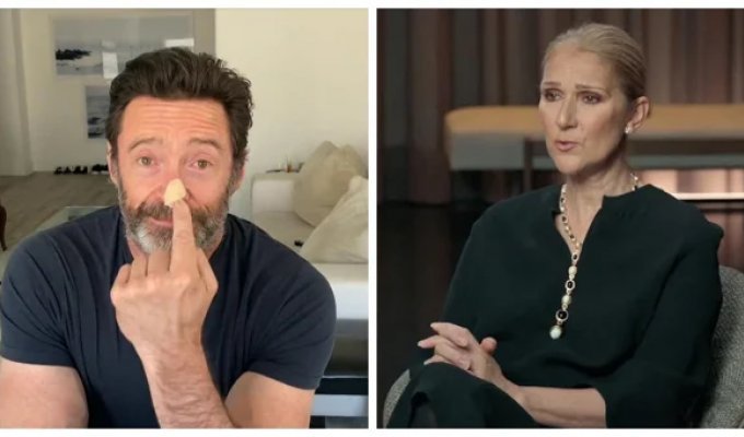 6 звёзд, которых не сломила тяжёлая болезнь (13 фото)