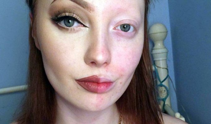 Интернет-тролли высмеяли и обозвали онкобольной девушку, запостившую селфи с "половинным" макияжем (4 фото)