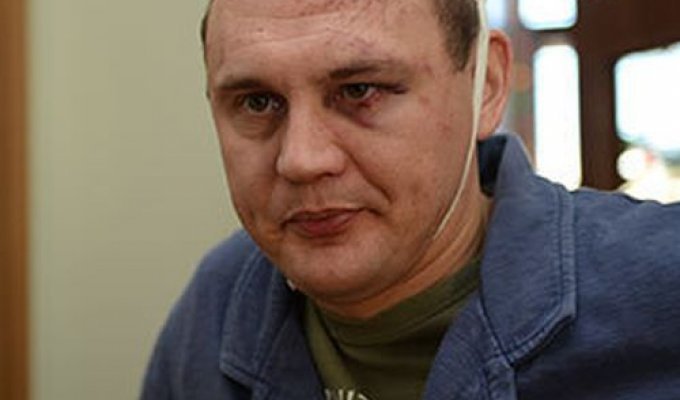 Звезду реалити-шоу "Дом-2" Степана Меньшикова жестоко избили (4 фото)