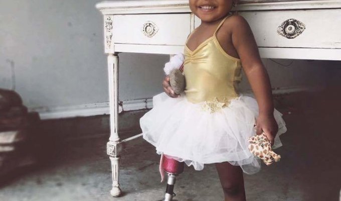 Аврора Каиро — очаровательная 2-летняя малышка с протезом ноги (6 фото)