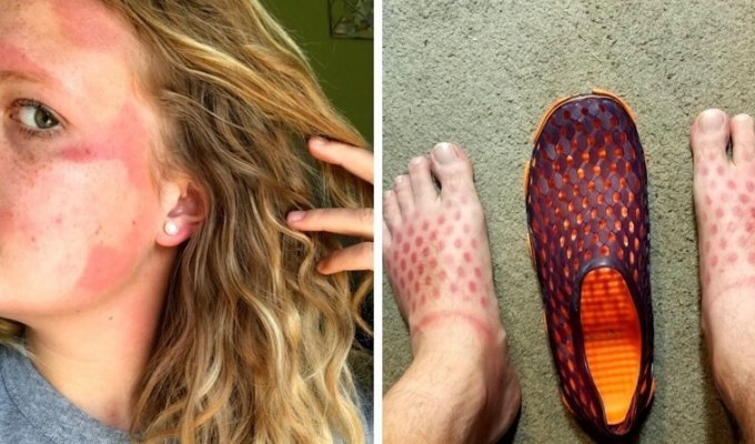 It hurts to look at: 16 people who overdid it with a tan (17 photos)