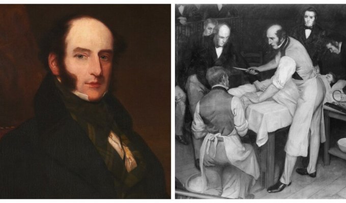 Robert Liston: I wanted the best, but got an absolute record for mortality (6 photos)
