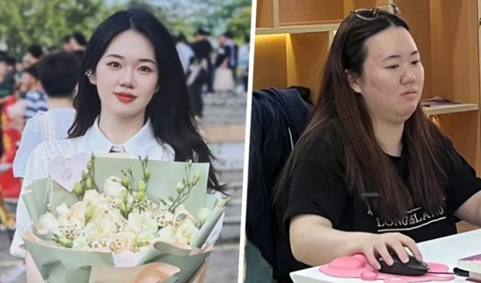 A Chinese woman gained 20 kg in a year due to stress at work (2 photos)