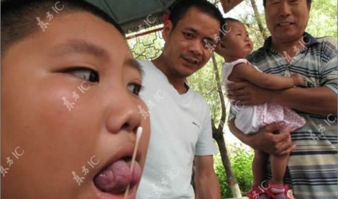 Мальчик со змеиным языком (6 фото)