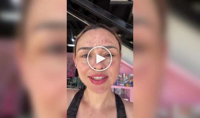 Девушка получила сильные ожоги лица на дне рождения