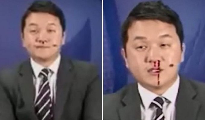 Репортер не ушел из эфира, несмотря на кровотечение из носа (5 фото + 1 видео)