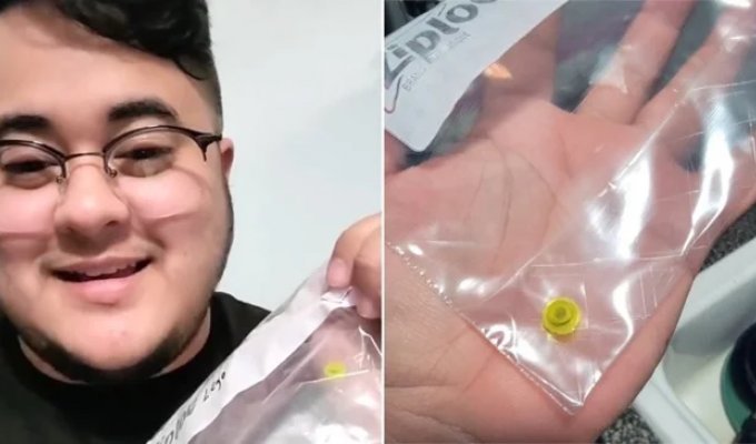 A guy lived with a Lego piece in his nose for over 25 years (3 photos + 1 video)