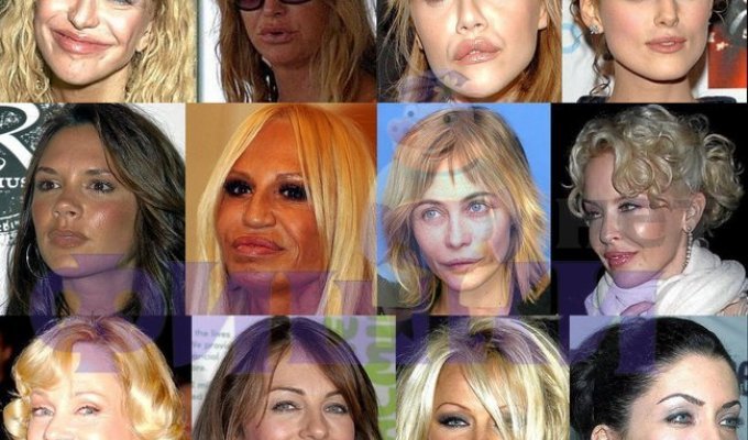 Celebrities before and after plastic surgery (12 photos)