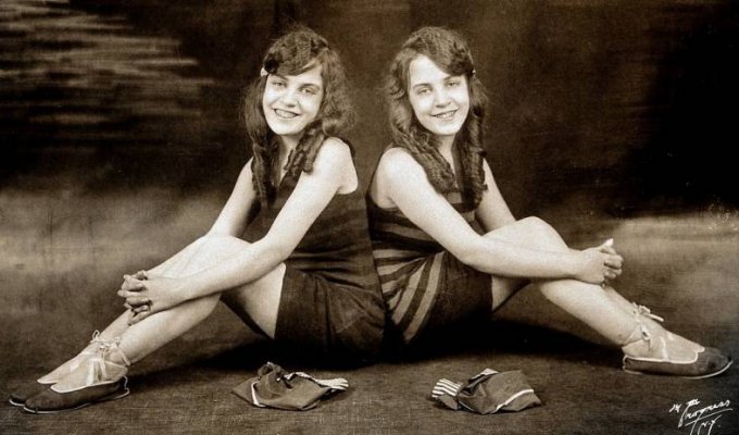 Жизнь сиамских близнецов Дейзи и Виолетты Хилтон (8 фото)
