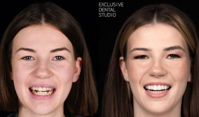 15 photos before and after people went to the dentist (16 photos)