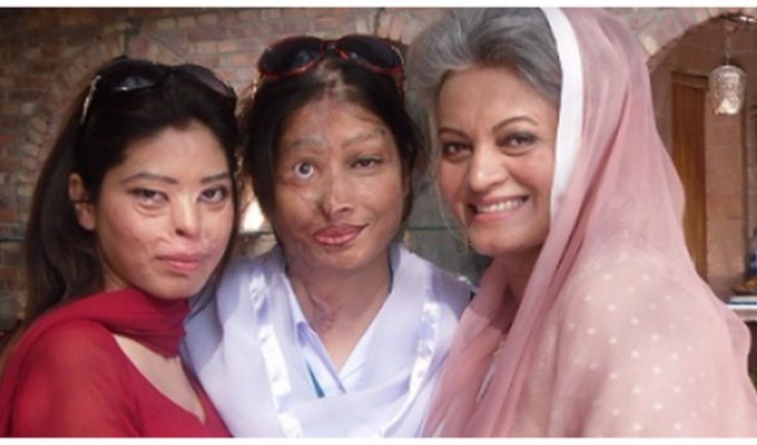 Владелица салонов красоты из Пакистана учит макияжу женщин, облитых кислотой (5 фото + 1 видео)