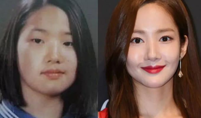 Unrecognizable – Asians become “outlaws” after plastic surgery (5 photos)