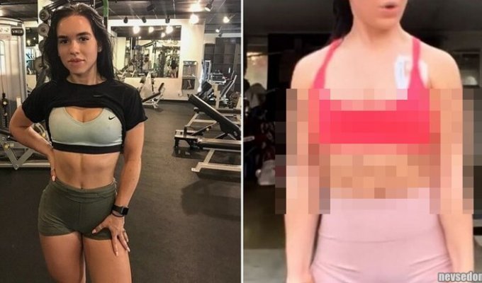 Fitness blogger decided to take injections to burn fat - and almost died (11 photos)