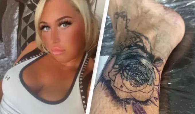 A Woman Almost Lost Her Leg After a Turkish Tattoo Parlor (6 photos)