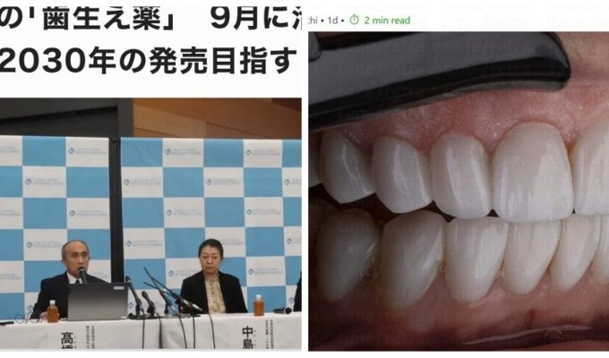 Перші у світі «ліки для зростання зубів» будуть випробувані в Японії з вересня 2024 року (3 фото)