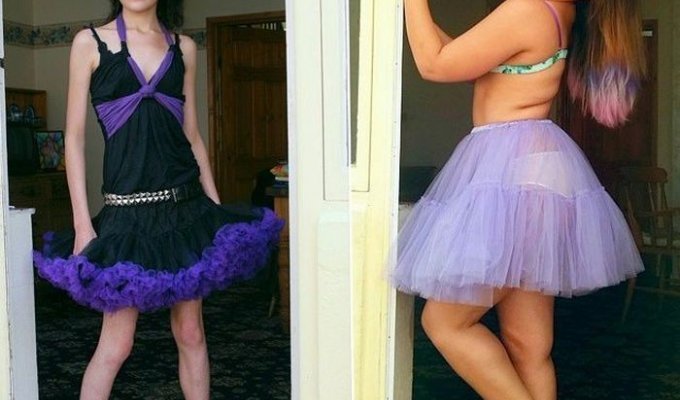 Девушка едва не умершая от анорексии набрала вес и публикует свои фото в бикини, чтобы помочь другим (12 фото)