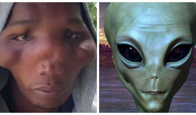 A strange disease turned half of a Dominican family into aliens (7 photos)