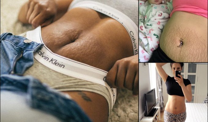 15 фото и историй женщин после беременности, которые мотивируют любить свое тело (16 фото)