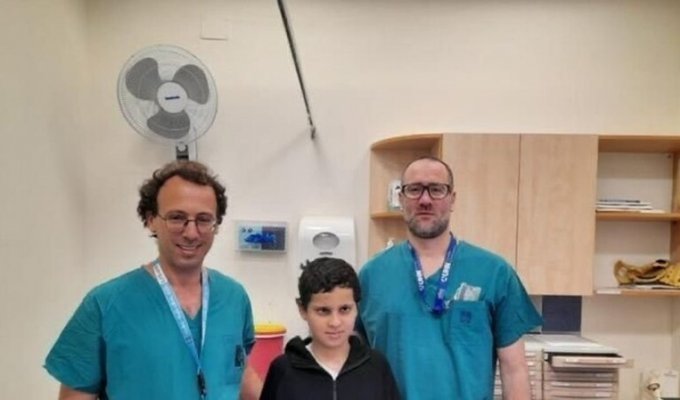 In Israel, doctors sewed the head of a 12-year-old boy injured in an accident (2 photos)