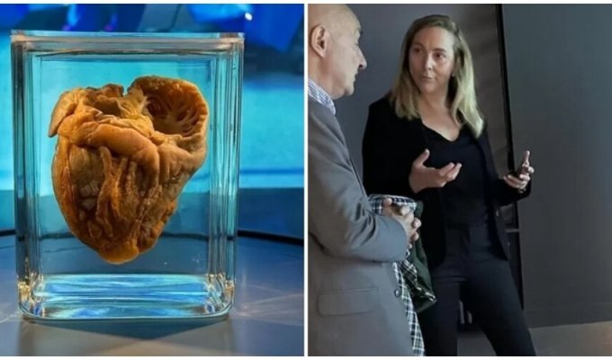 16 years later, a woman saw her heart in a museum (4 photos)