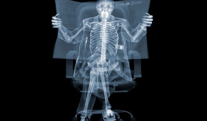 Рентгеновский взгляд на мир Ника Визи (56 фото)