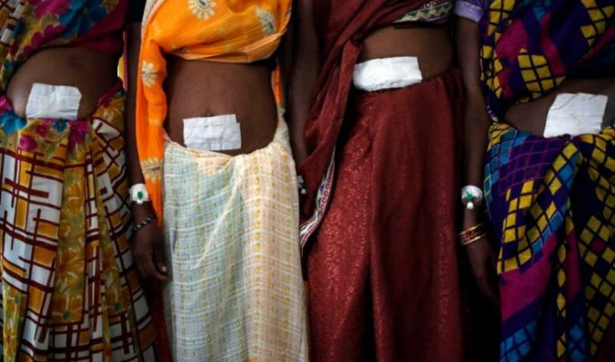 Смертельная стерилизация женщин в Индии (16 фото)