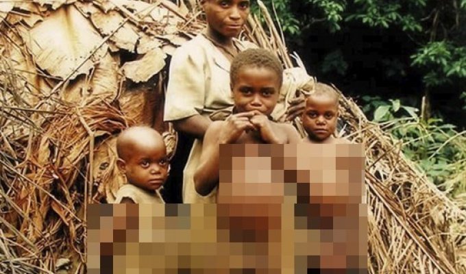 Why do African children often have such big bellies? (5 photos)