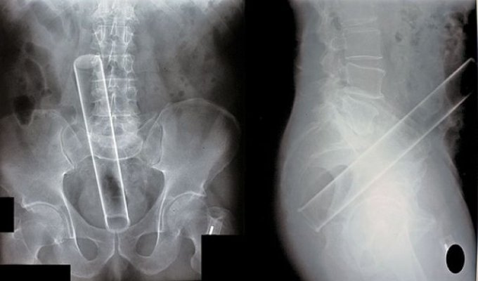 Интересные рентгеновские снимки (15 фото)