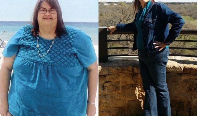 В свои 51 эта женщина весила больше 190 кг (8 фото)