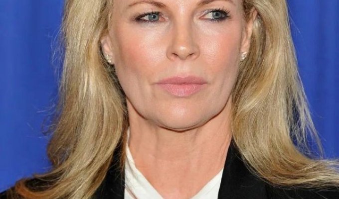 Kim Basinger has changed beyond recognition after plastic surgery (2 photos)
