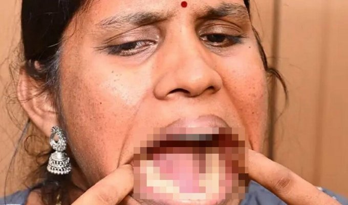 An Indian woman with 38 teeth entered the Guinness Book of Records (4 photos)
