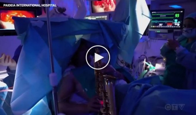 В Италии мужчине 9 часов удаляли опухоль мозга, пока он играл на саксофоне