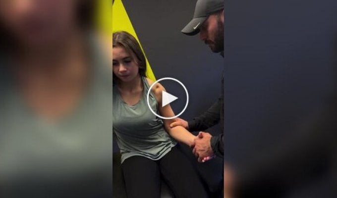 Спортивный врач ювелирно вправил руку спортсменке