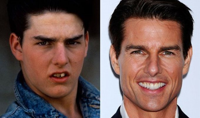 Звезды до и после стоматолога (10 фотографий)
