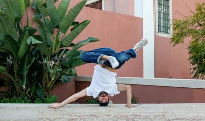 A breakdancer who constantly spun on his head earned himself a bald spot and a growth on his skull (2 photos)