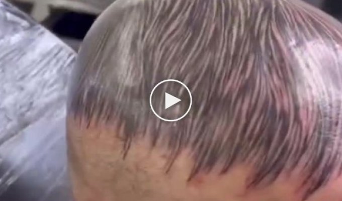 Great way to get rid of baldness