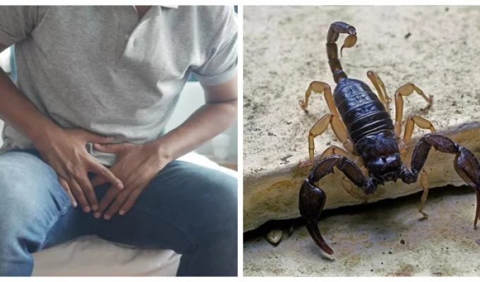 Scorpion Sting Ruins Sex Life of Luxury Hotel Guest (4 photos)