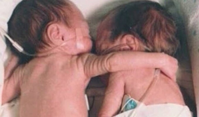 Медсестра кладёт здорового ребёнка рядом с умирающим близнецом и тут происходит настоящее чудо! (3 фото + 1 видео)